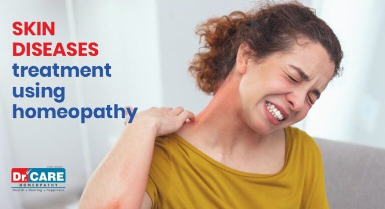 Skin Diseases Treatment Using Homeopathy