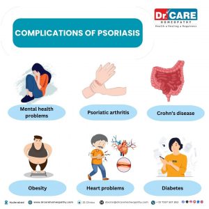 Complications of psoriasis, psoriasis complications