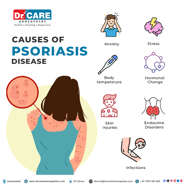 causes of psoriasis, psoriasis causes