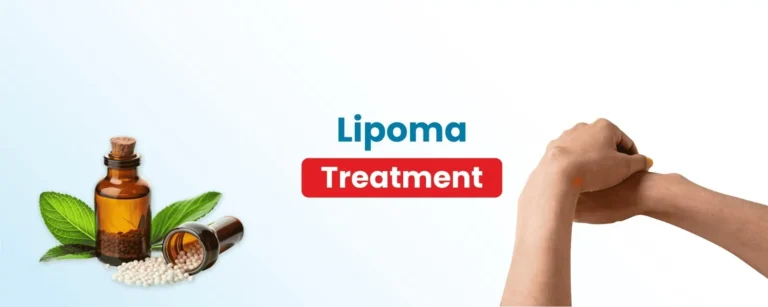 lipoma
