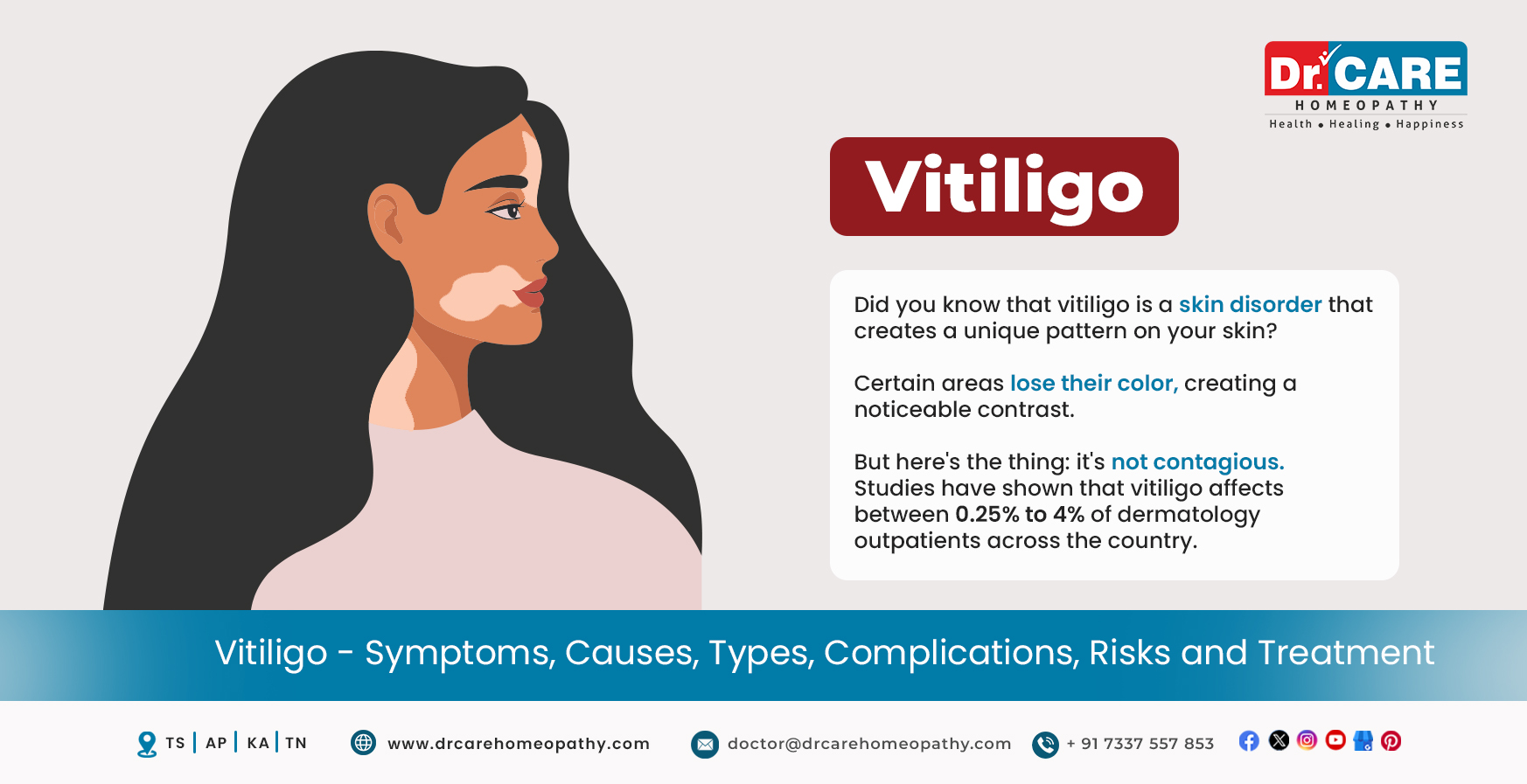 Vitiligo: Signs, Symptoms, Causes, Types, Complications Prevention And Treatment