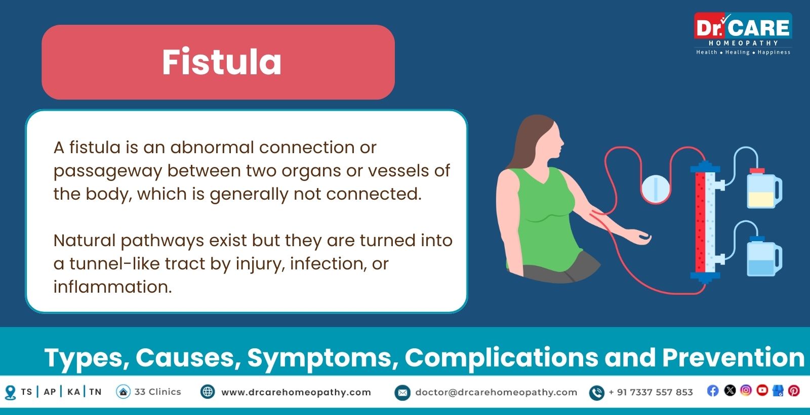 Fistula Types: Causes, Symptoms, Complications and Prevention