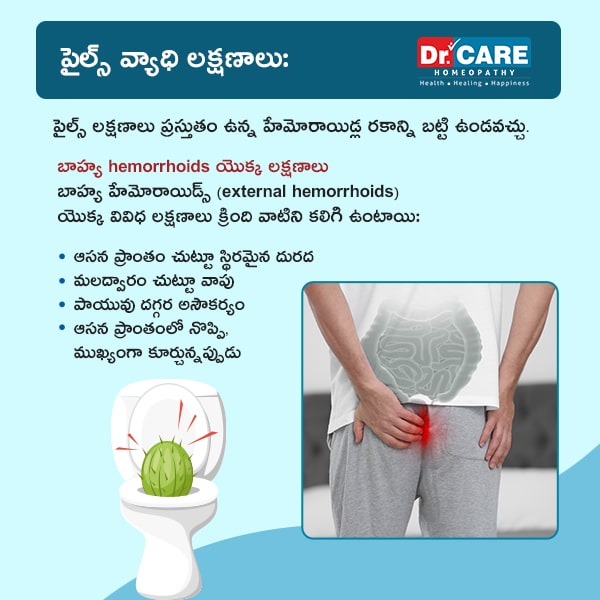 symptoms piles in telugu | piles symptoms in telugu | external hemorrhoids symptoms in telugu | symptoms of piles in women in telugu | symptoms of piles in telugu |external hemorrhoids in telugu