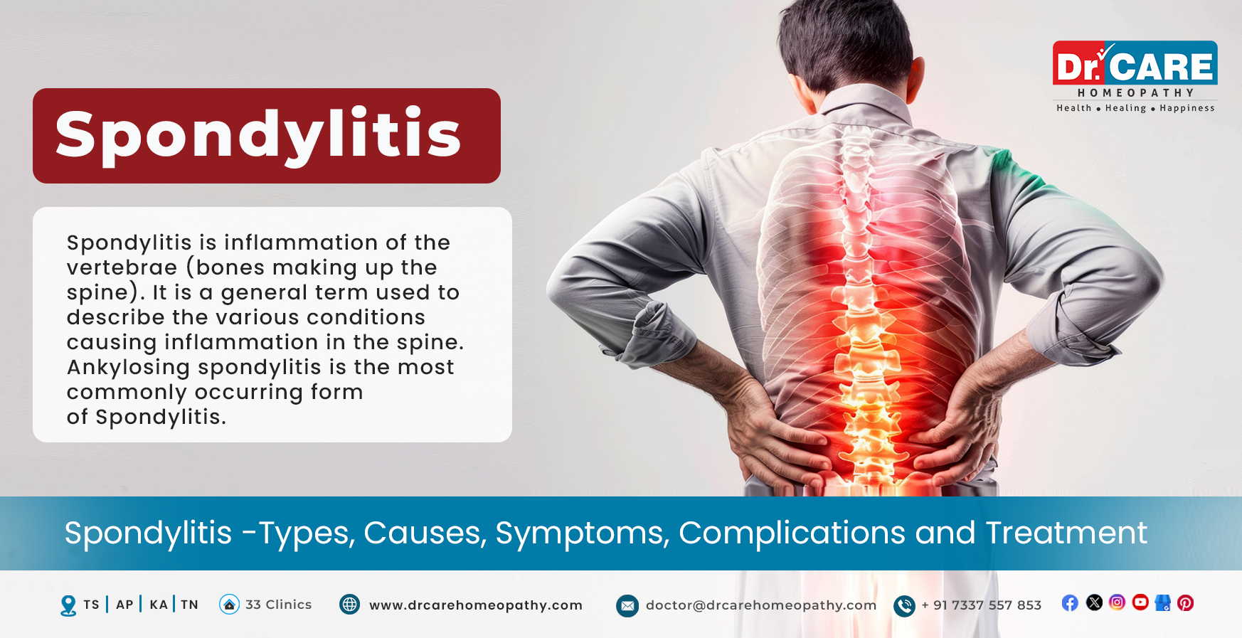 Spondylitis: Types, Causes, Symptoms, Complications and Treatment