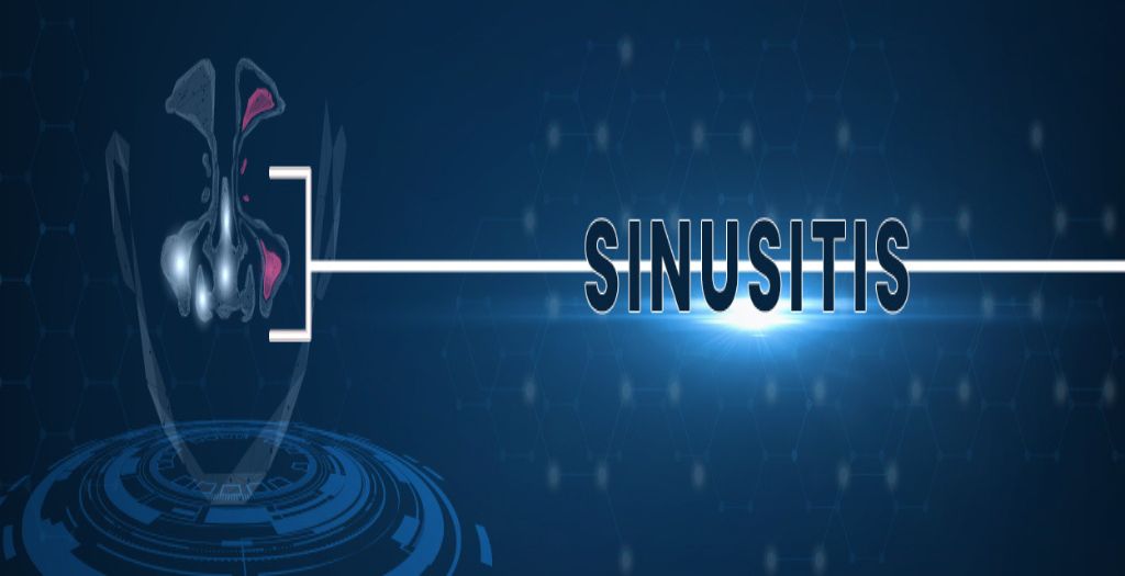 sinusitis-blog