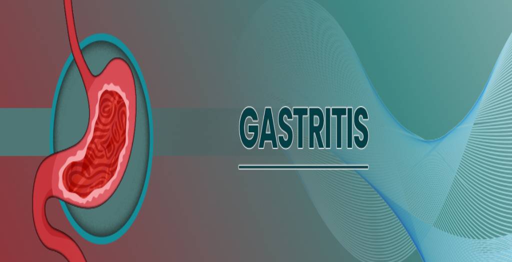 Blog 28 gastritis-blog