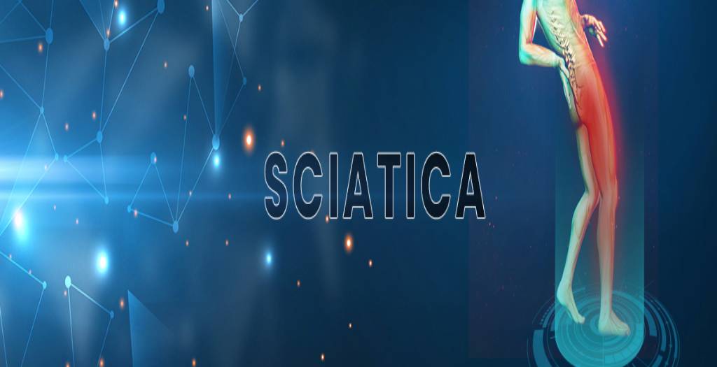 Blog 26 sciatic-blog