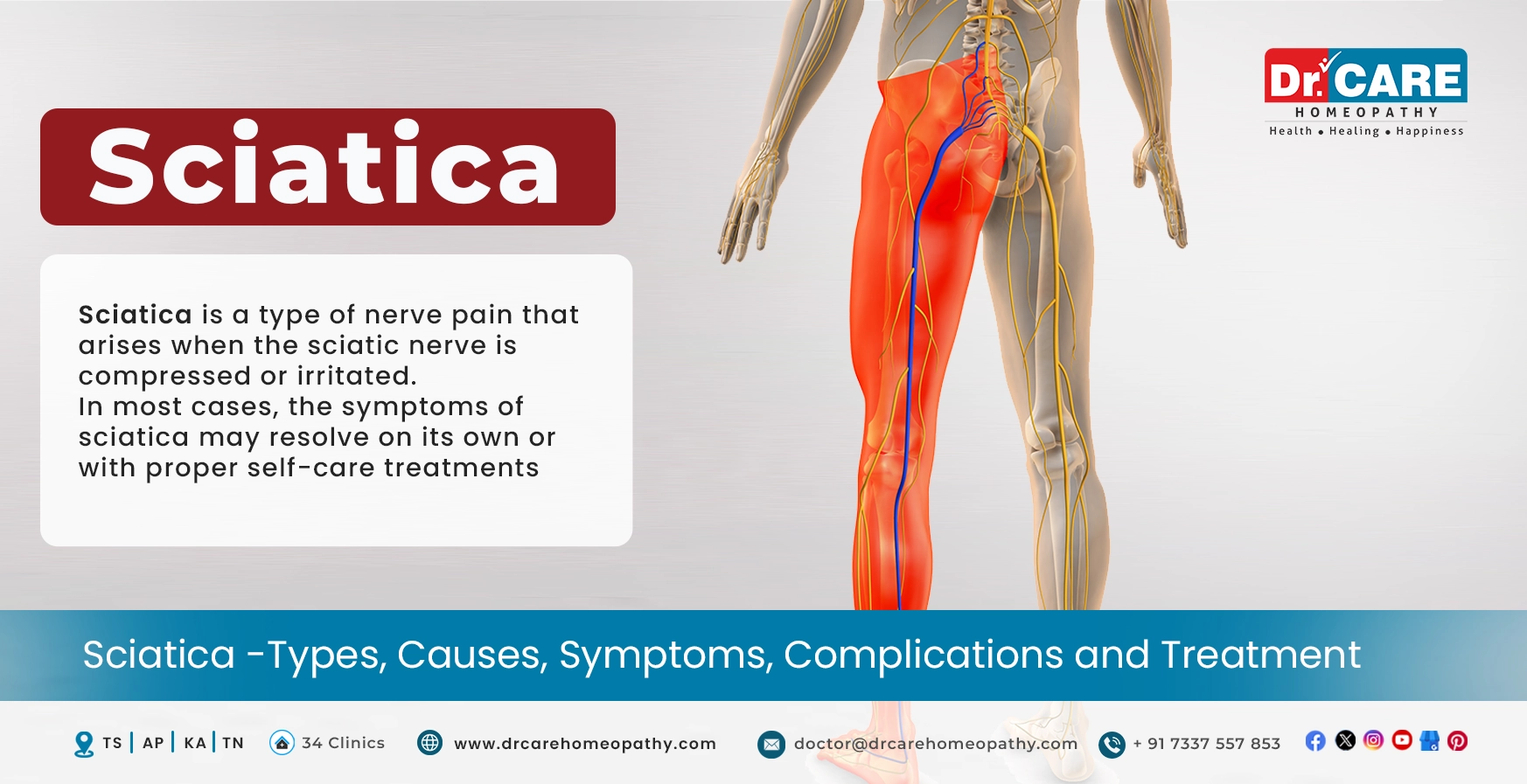 Sciatica: Causes, Symptoms, Diagnosis, Complications and Treatment