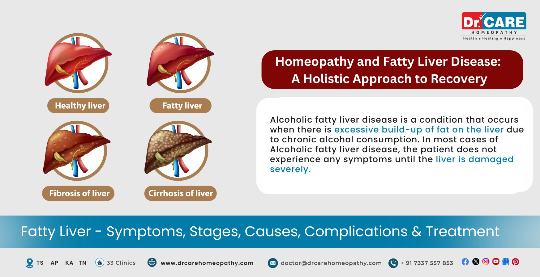 Homeopathy and Fatty Liver Disease: A Holistic Approach to Recovery