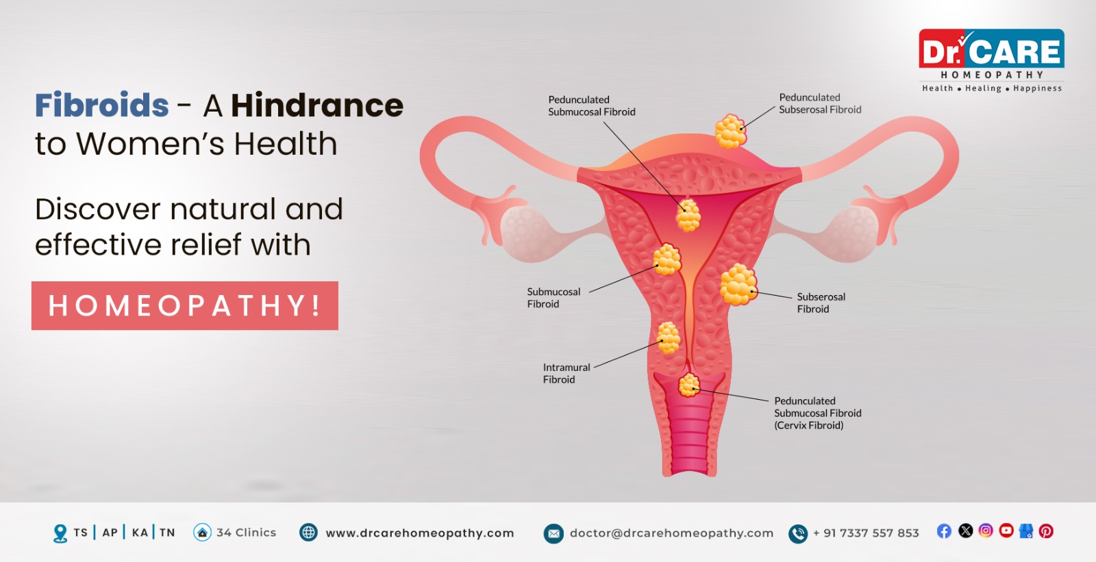 Effective Homeopathic Treatment for Uterine Fibroids, Causes, Symptoms