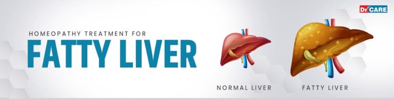 Homeopathic-Treatment-for-Fatty-liver-1920w