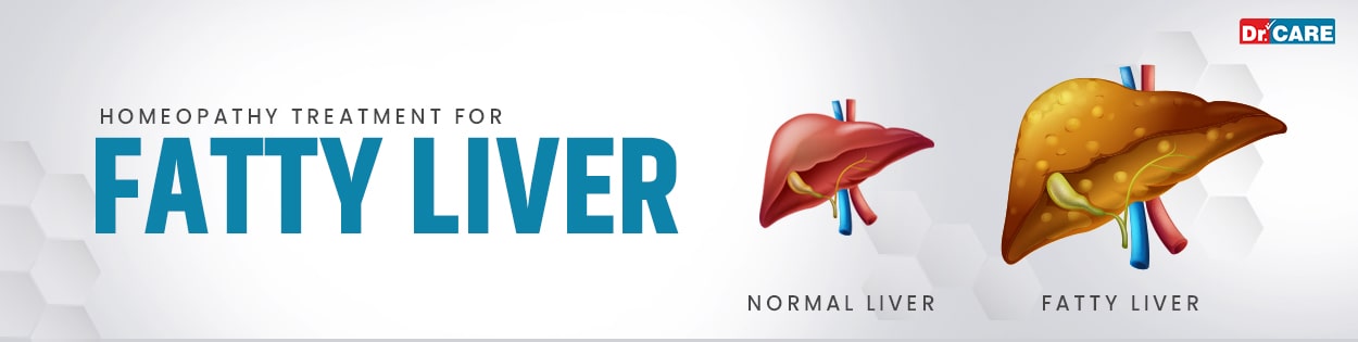 Blog 18 Homeopathic-Treatment-for-Fatty-liver-1920w