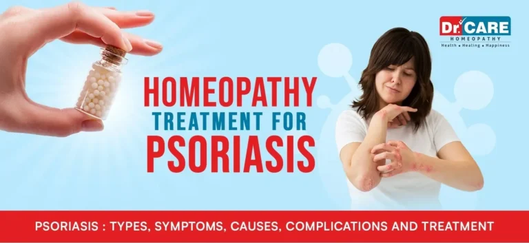 Psoriasis