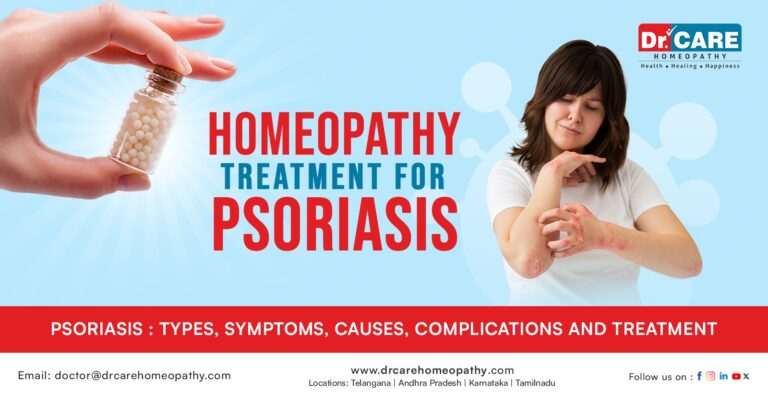 Homeopathy Treatment for Psoriasis Near You