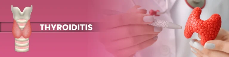 Homoeopathic-treatment-for-Thyroiditis