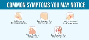 What are the common signs and symptoms of Psoriasis