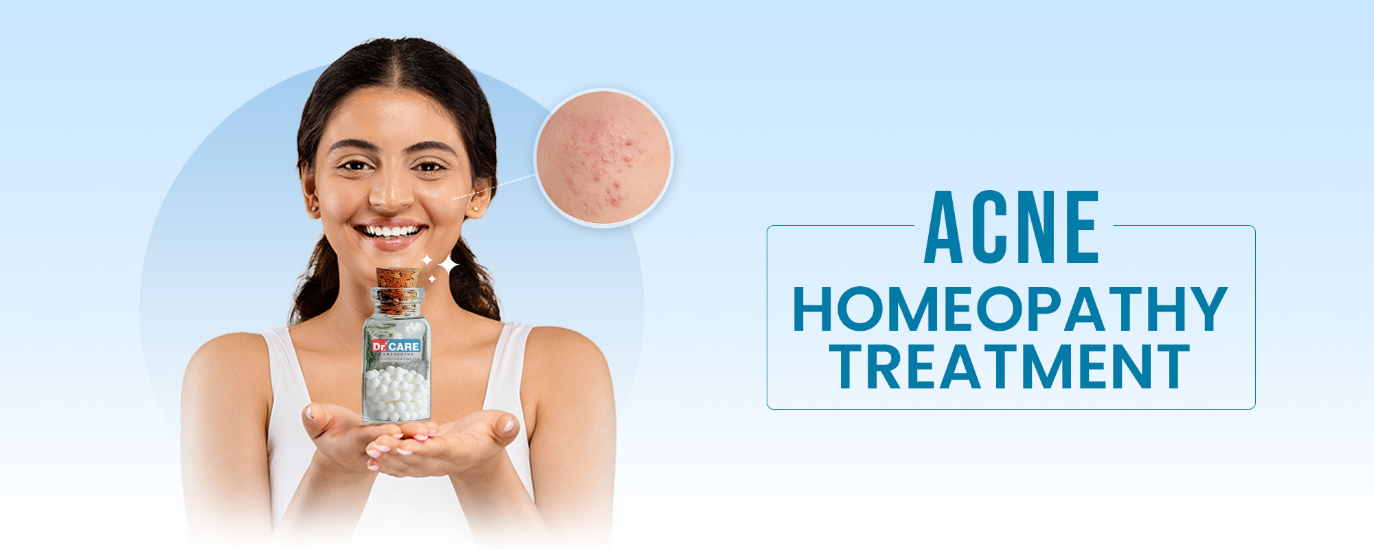 ACNE TreatmentsBanner 2000X800