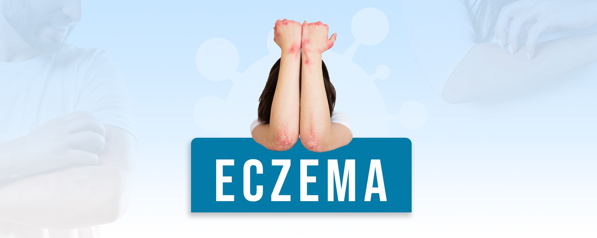 Eczema TreatmentsBanner 2000X800