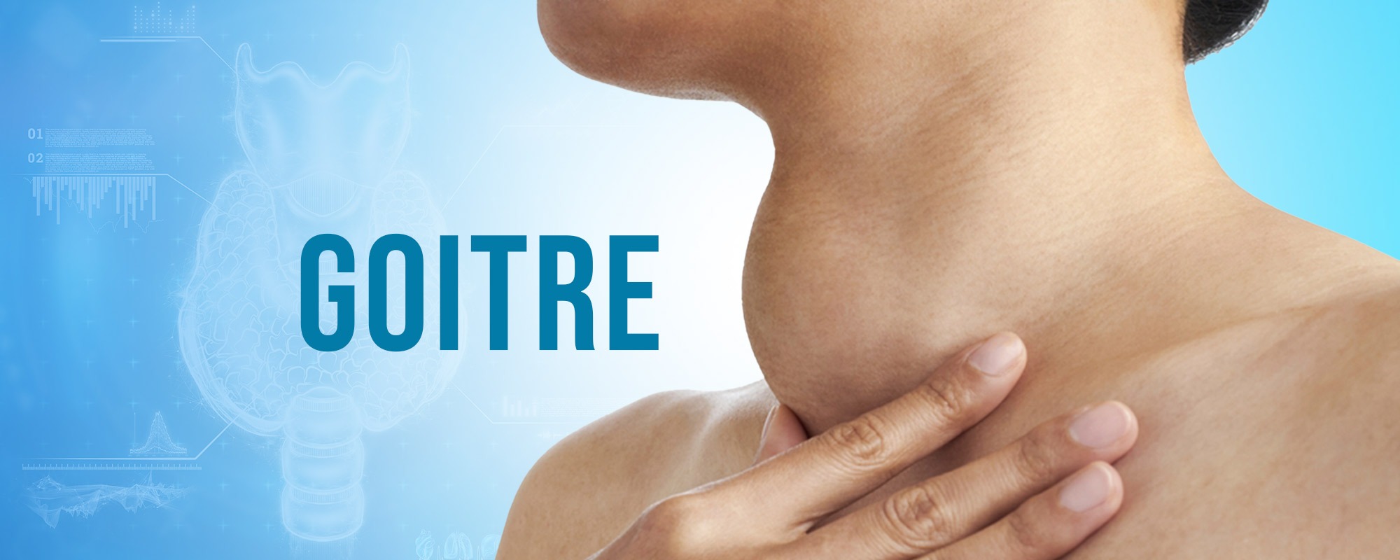 Goitre Treatments