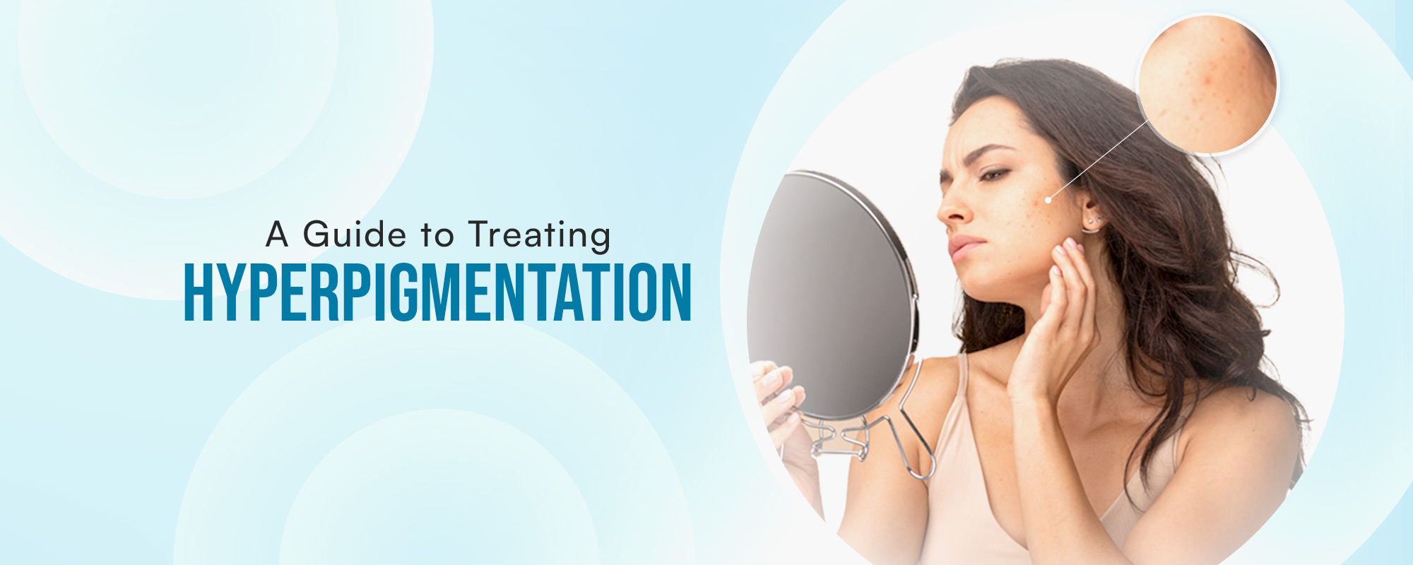 Hyperpigmentation Treatments
