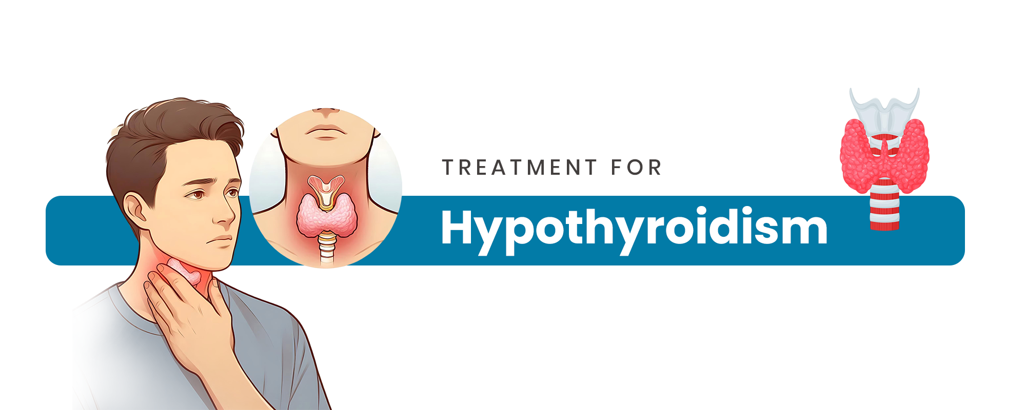 Hypothyroidism