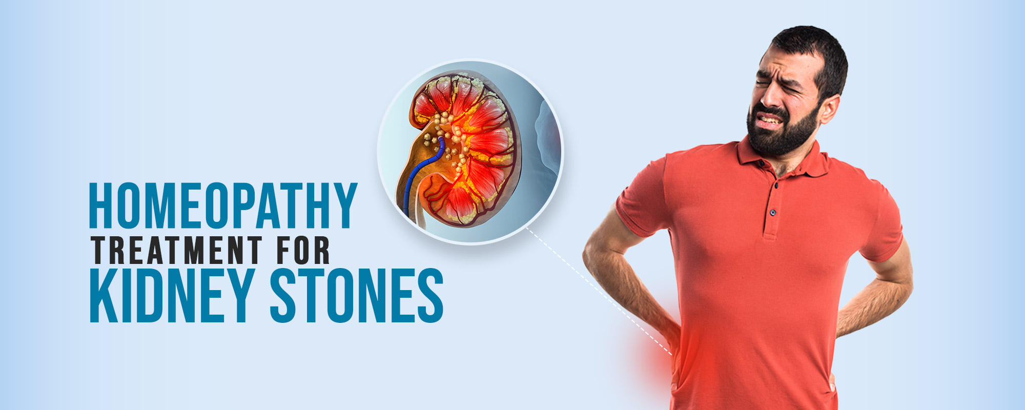 Kidney Stones Treatments