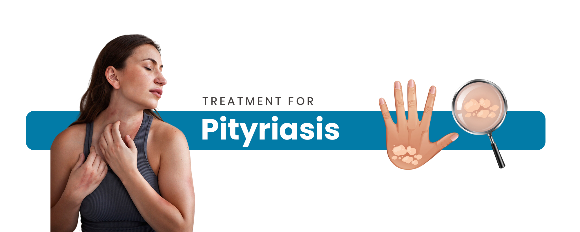 Pityriasis
