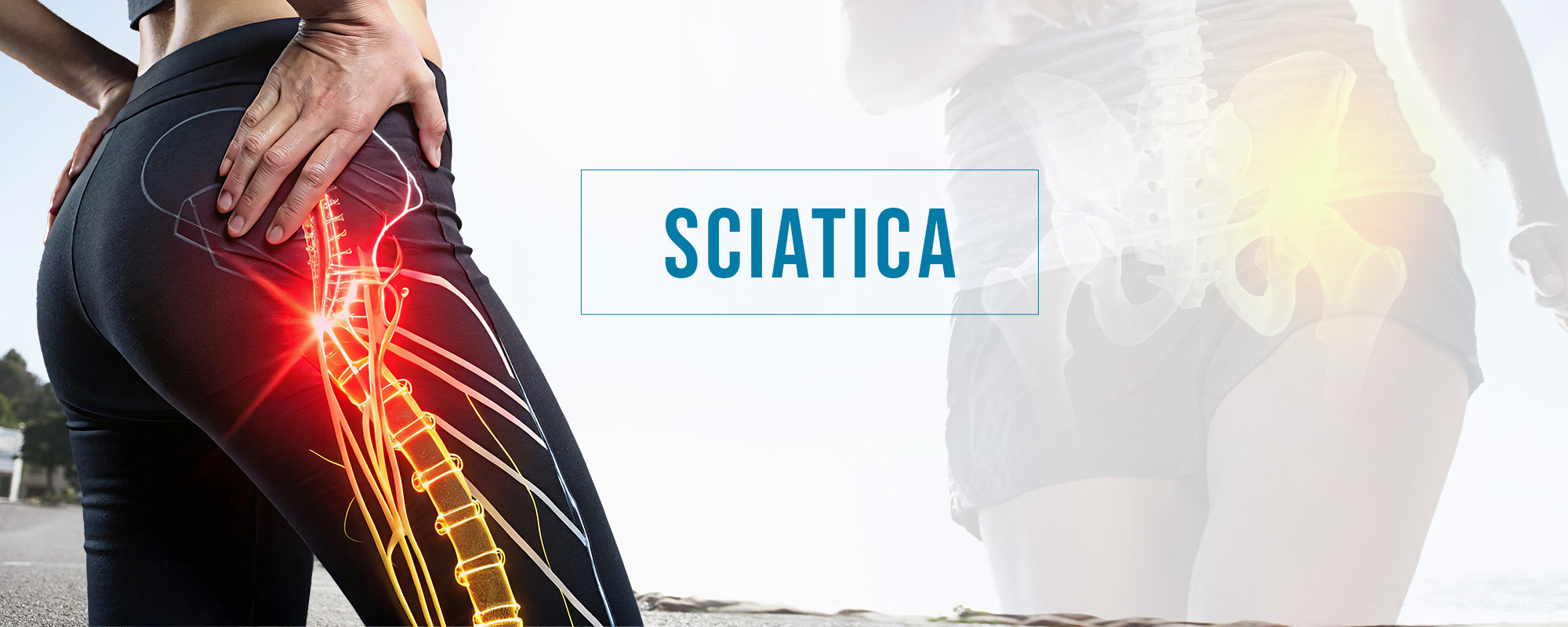 Sciatica Treatments