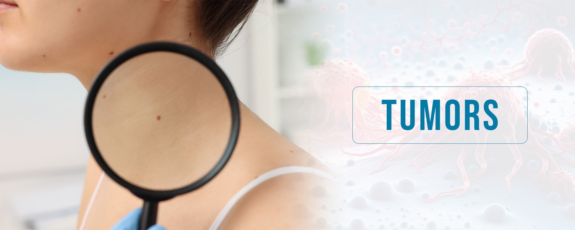 Tumors TreatmentsBanner 2000X800