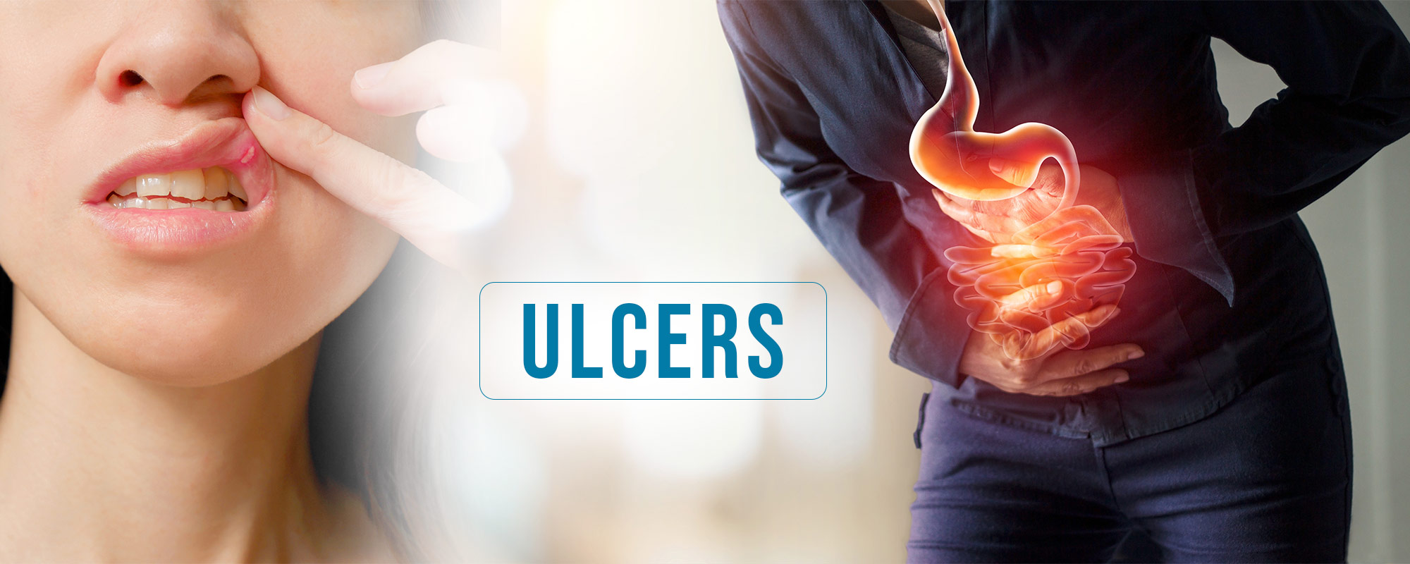 Ulcers TreatmentsBanner 2000X800