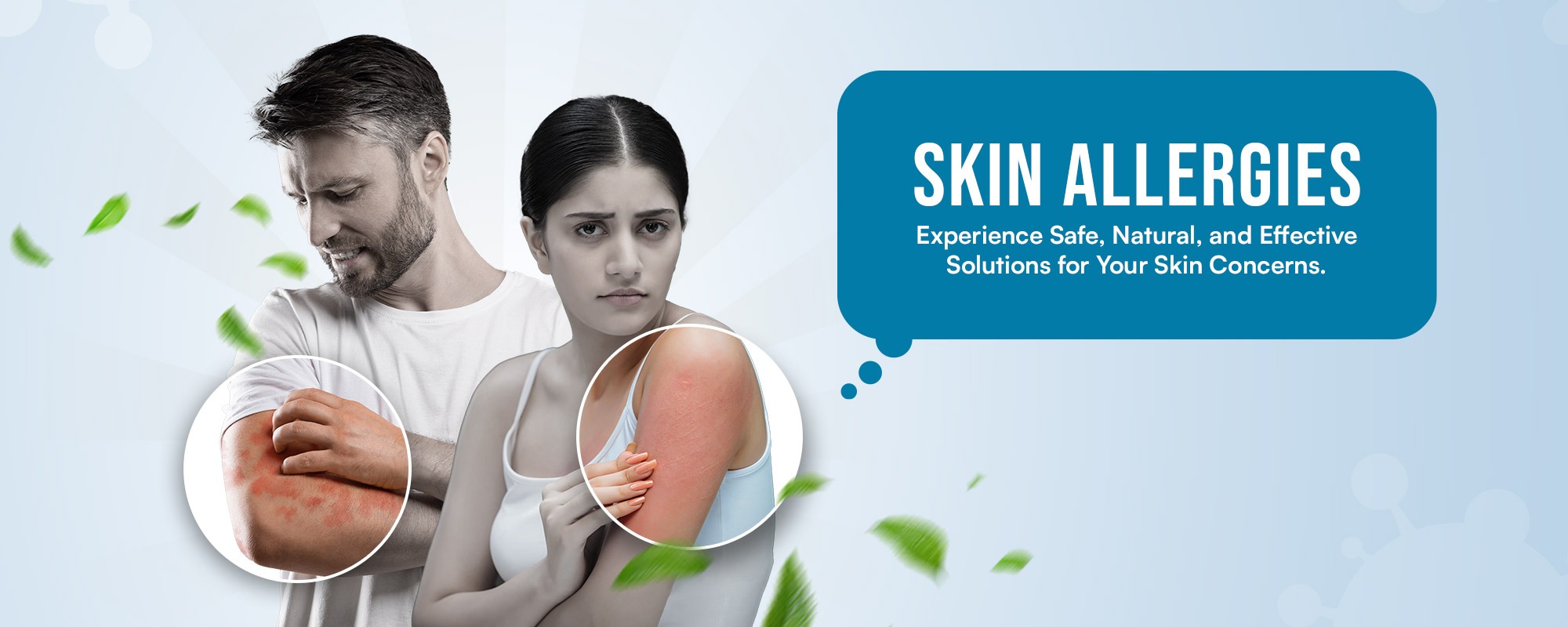 skin Allergies Treatments