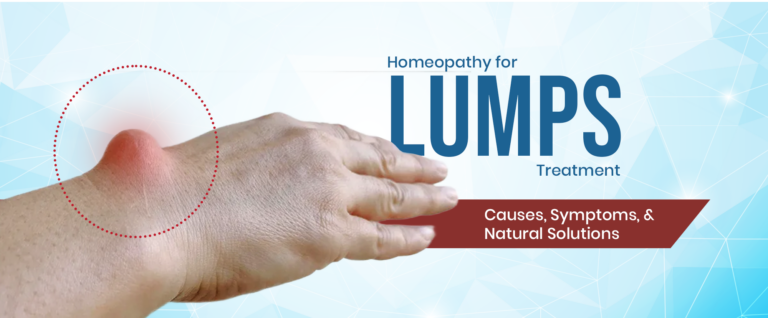 Looking for safe non-surgical Homeopathy Treatment for Lumps and other lumps? Dr. Care offers personalised, natural care across clinics in Hyderabad and South India.