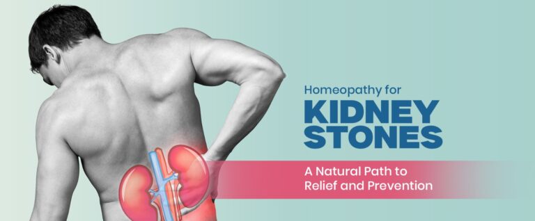 Homeopathy for Kidney Stones