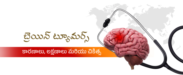 బ్రెయిన్ ట్యూమర్స్
