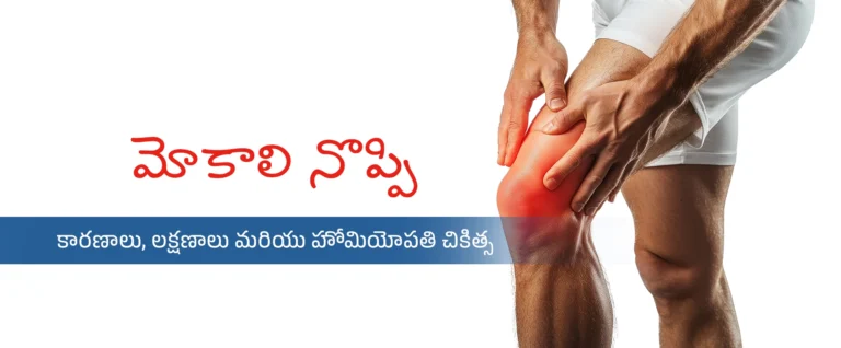 మోకాళ్ల నొప్పి – కారణాలు, లక్షణాలు & హోమియోపతి చికిత్స
