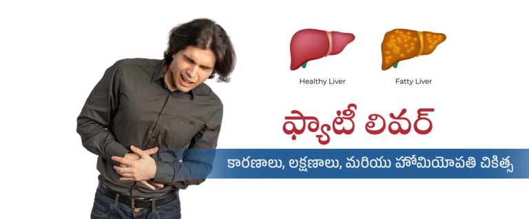 ఫ్యాటీ లివర్ కారణాలు లక్షణాలు మరియు హోమియోపతి చికిత్స