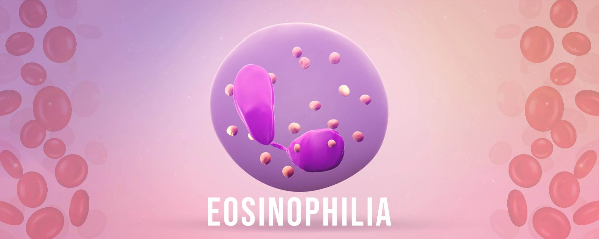 Eosinophilia-Treatments