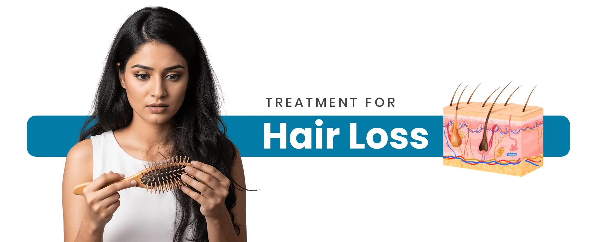 Hair-Loss
