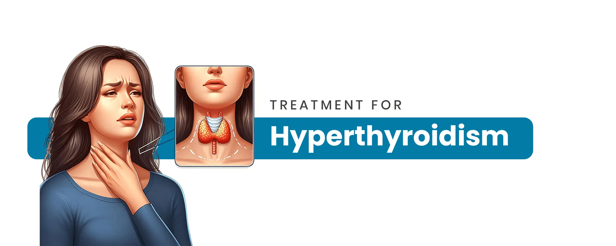 Hyperthyroidism