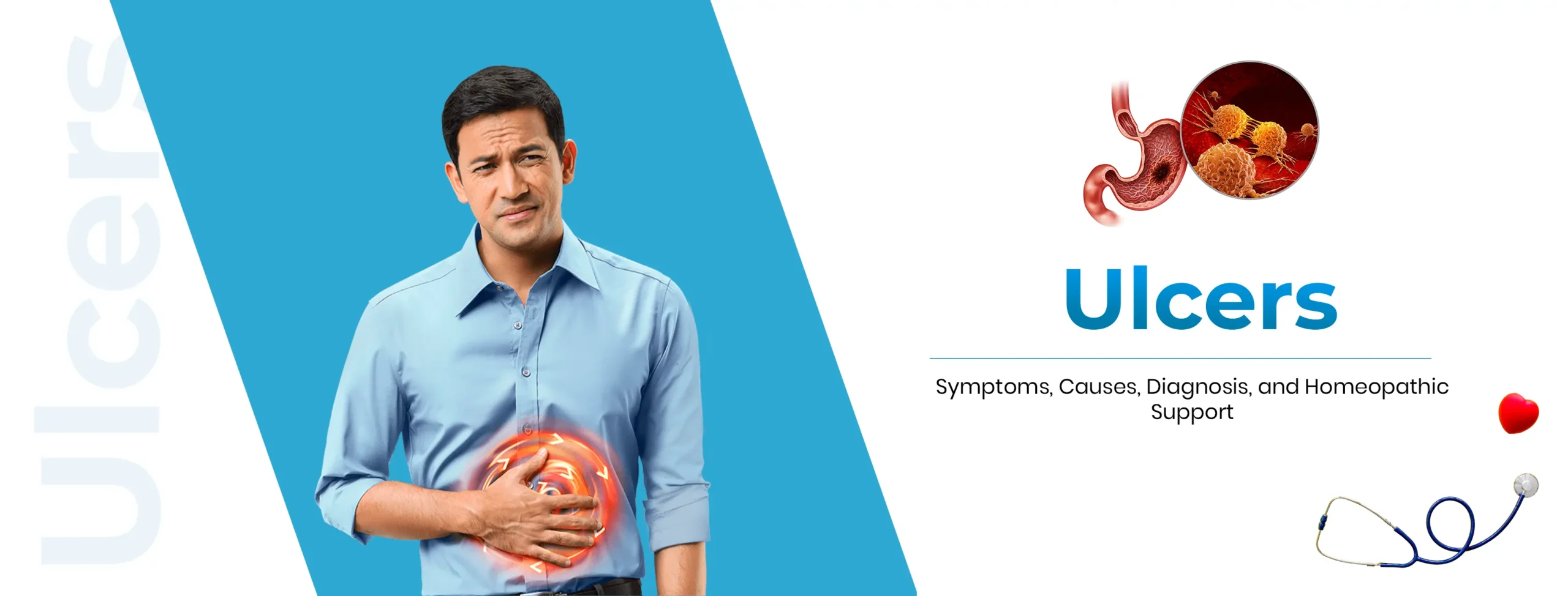 ulcers treatment with homeopathy